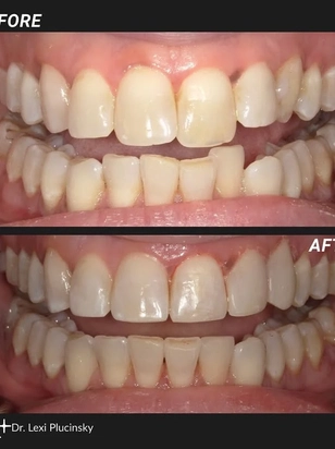University Suburban Dental Instagram photo 2