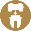 Dental Crowns